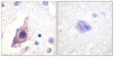 CDC25B Antibody - Peptide - + Immunohistochemistry analysis of paraffin-embedded human brain tissue using CDC25B (Ab-353) antibody.