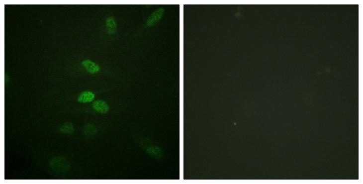 CDC25B Antibody - Peptide - + Immunofluorescence analysis of HeLa cells, using CDC25B (Ab-353) antibody.