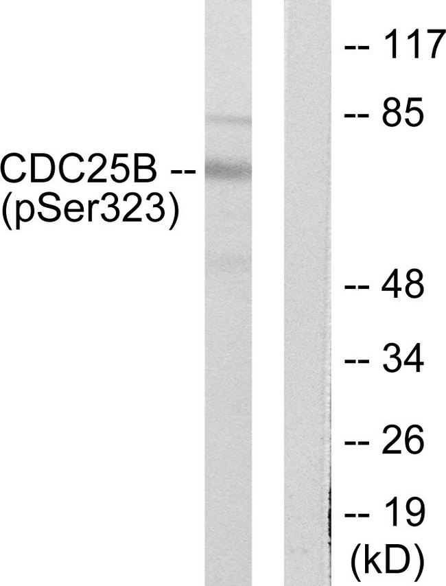 CDC25B Antibody - Western blot analysis of lysates from NIH/3T3 cells treated with PMA 125ng/ml 30', using CDC25B (Phospho-Ser323) Antibody. The lane on the right is blocked with the phospho peptide.
