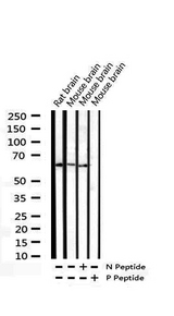 CDC25B Antibody - Western blot analysis of Phospho-CDC25B (Ser323) expression in various lysates