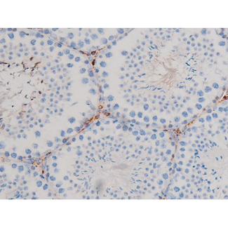 CDC25B Antibody - 1:200 staining mouse testis tissue by IHC-P. The tissue was formaldehyde fixed and a heat mediated antigen retrieval step in citrate buffer was performed. The tissue was then blocked and incubated with the antibody for 1.5 hours at 22°C. An HRP conjugated goat anti-rabbit antibody was used as the secondary.