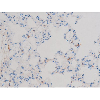 CDC25B Antibody - 1:200 staining rat lung tissue by IHC-P. The tissue was formaldehyde fixed and a heat mediated antigen retrieval step in citrate buffer was performed. The tissue was then blocked and incubated with the antibody for 1.5 hours at 22°C. An HRP conjugated goat anti-rabbit antibody was used as the secondary.