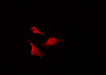 CDC25B Antibody - Staining NIH-3T3 cells by IF/ICC. The samples were fixed with PFA and permeabilized in 0.1% Triton X-100, then blocked in 10% serum for 45 min at 25°C. The primary antibody was diluted at 1:200 and incubated with the sample for 1 hour at 37°C. An Alexa Fluor 594 conjugated goat anti-rabbit IgG (H+L) Ab, diluted at 1/600, was used as the secondary antibody.