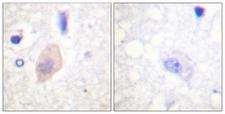 CDC25B Antibody - Immunohistochemistry analysis of paraffin-embedded human brain, using CDC25B (Phospho-Ser353) Antibody. The picture on the right is blocked with the phospho peptide.