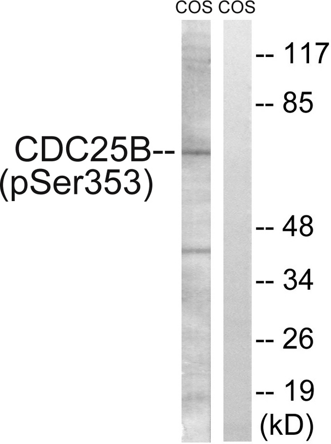 CDC25B Antibody - Western blot analysis of lysates from COS7 cells treated with etoposide 25uM 24h, using CDC25B (Phospho-Ser353) Antibody. The lane on the right is blocked with the phospho peptide.