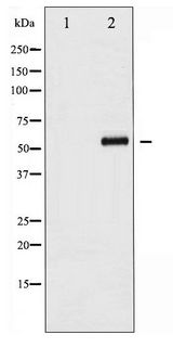 CDC25B Antibody - Western blot of CDC25B phosphorylation expression in etoposide treated COS7 whole cell lysates,The lane on the left is treated with the antigen-specific peptide.