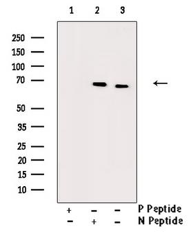 CDC25B Antibody - Western blot analysis of Phospho-CDC25B (Ser353) antibody expression in etoposide treated COS7 cells lysates. The lane on the right is treated with the antigen-specific peptide.