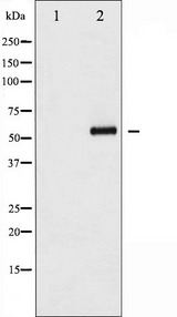 CDC25B Antibody - Western blot analysis of CDC25B phosphorylation expression in etoposide treated COS7 whole cells lysates. The lane on the left is treated with the antigen-specific peptide.