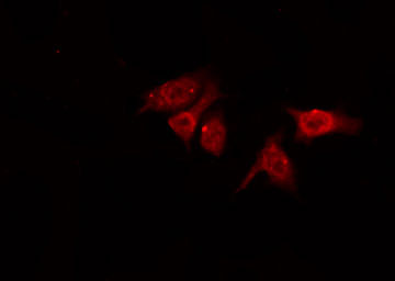 CDC25B Antibody - Staining NIH-3T3 cells by IF/ICC. The samples were fixed with PFA and permeabilized in 0.1% Triton X-100, then blocked in 10% serum for 45 min at 25°C. The primary antibody was diluted at 1:200 and incubated with the sample for 1 hour at 37°C. An Alexa Fluor 594 conjugated goat anti-rabbit IgG (H+L) Ab, diluted at 1/600, was used as the secondary antibody.