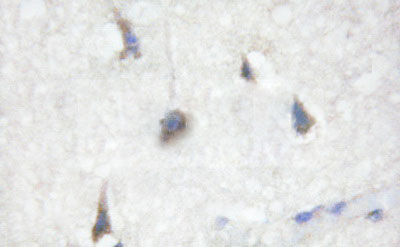 CDC25B Antibody - 1/100 staining human brain tissue by IHC-P. The sample was formaldehyde fixed and a heat mediated antigen retrieval step in citrate buffer was performed. The sample was then blocked and incubated with the antibody for 1.5 hours at 22°C. An HRP conjugated goat anti-rabbit antibody was used as the secondary antibody.