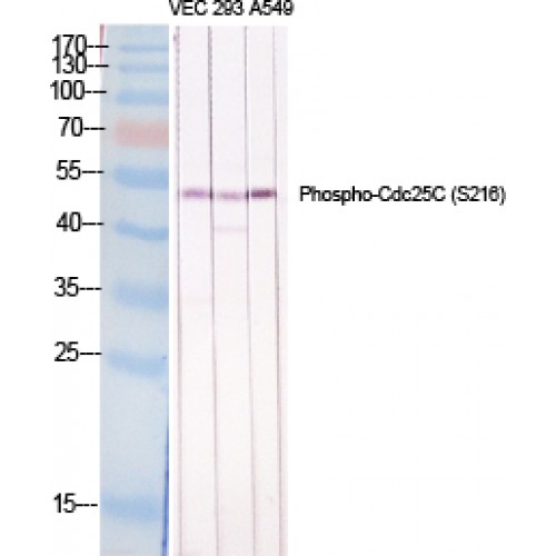 CDC25C Antibody - Western blot of Phospho-Cdc25C (S216) antibody