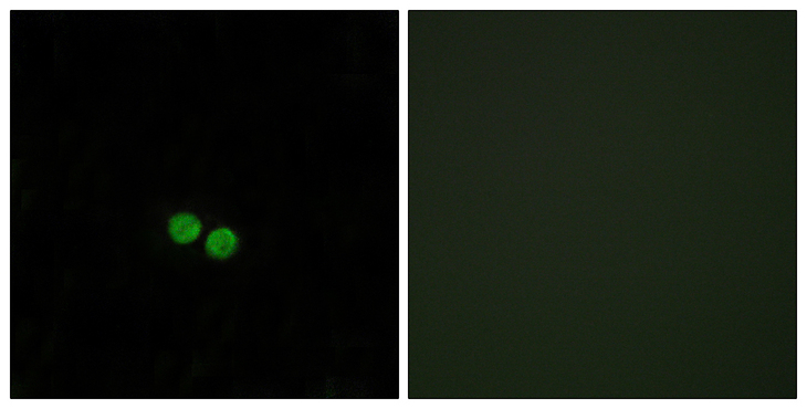 CDC25C Antibody - Immunofluorescence analysis of HepG2 cells, using CDC25C Antibody. The picture on the right is blocked with the synthesized peptide.