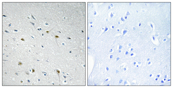 CDC25C Antibody - Immunohistochemistry analysis of paraffin-embedded human brain tissue, using CDC25C Antibody. The picture on the right is blocked with the synthesized peptide.