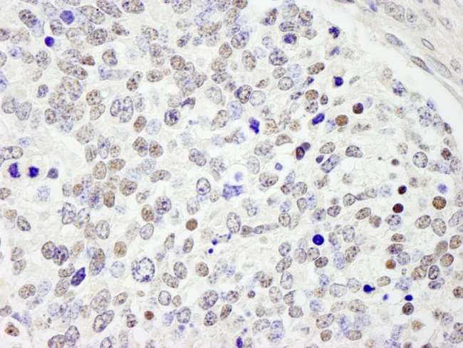 CDC25C Antibody - Detection of Mouse CDC25c by Immunohistochemistry. Sample: FFPE section of mouse teratoma. Antibody: Affinity purified rabbit anti-CDC25c used at a dilution of 1:250.
