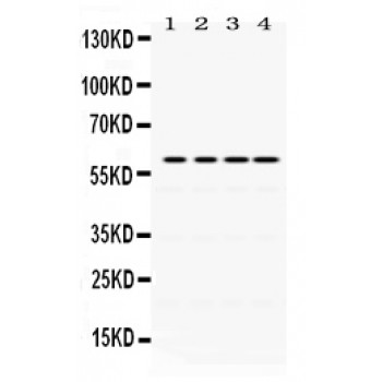 CDC25C Antibody - Cdc25C antibody Western blot. All lanes: Anti Cdc25C at 0.5 ug/ml. Lane 1: Rat Ovary Tissue Lysate at 50 ug. Lane 2: Rat Liver Tissue Lysate at 50 ug. Lane 3: HELA Whole Cell Lysate at 40 ug. Lane 4: SW620 Whole Cell Lysate at 40 ug. Predicted band size: 60 kD. Observed band size: 60 kD.