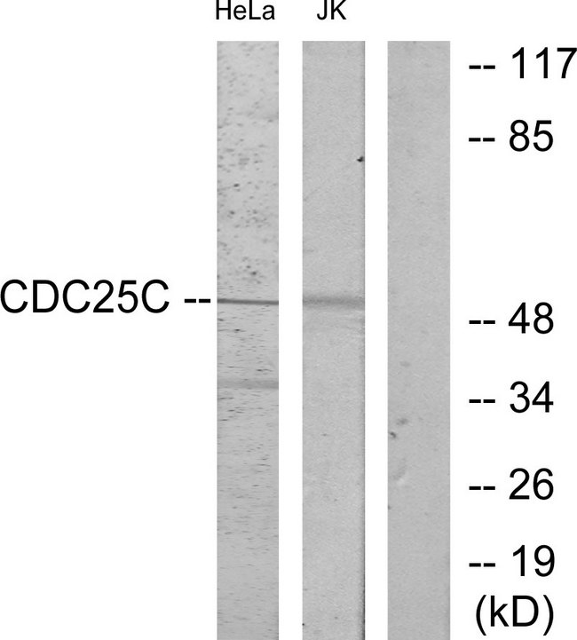 CDC25C Antibody - Western blot analysis of lysates from HeLa and Jurkat cells, using CDC25C Antibody. The lane on the right is blocked with the synthesized peptide.