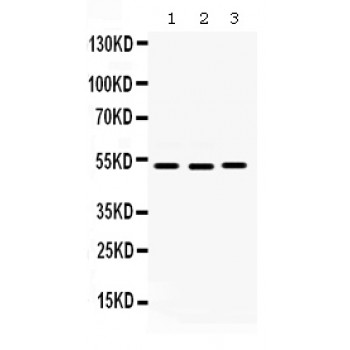 CDC25C Antibody - Western blot analysis of Cdc25C expression in HELA whole cell lysates (lane 1), SW620 whole cell lysates (lane 2) and MCF-7 whole cell lysates (lane 3). Cdc25C at 53 kD was detected using rabbit anti- Cdc25C Antigen Affinity purified polyclonal antibody at 0.5 ug/mL. The blot was developed using chemiluminescence (ECL) method.