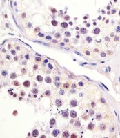 CDC25C Antibody - Antibody staining MPIP3 in human testis sections by Immunohistochemistry (IHC-P - paraformaldehyde-fixed, paraffin-embedded sections). Tissue was fixed with formaldehyde and blocked with 3% BSA for 0. 5 hour at room temperature; antigen retrieval was by heat mediation with a citrate buffer (pH 6). Samples were incubated with primary antibody (1:25) for 1 hours at 37°C. A undiluted biotinylated goat polyvalent antibody was used as the secondary antibody.