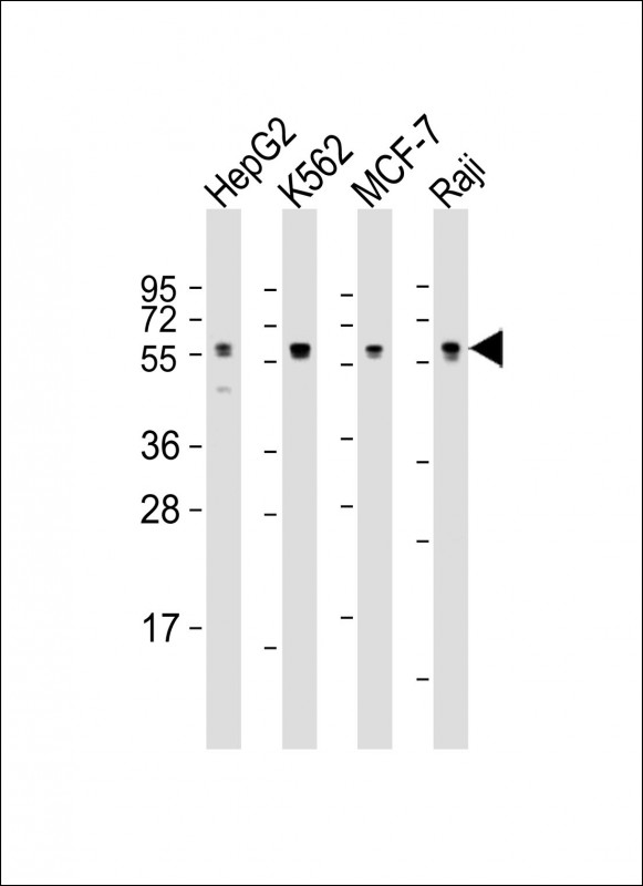 CDC25C Antibody - All lanes: Anti-MPIP3 Antibody at 1:1000-1:2000 dilution. Lane 1: HepG2 whole cell lysate. Lane 2: K562 whole cell lysate. Lane 3: MCF-7 whole cell lysate. Lane 4: Raji whole cell lysate Lysates/proteins at 20 ug per lane. Secondary Goat Anti-mouse IgG, (H+L), Peroxidase conjugated at 1:10000 dilution. Predicted band size: 53 kDa. Blocking/Dilution buffer: 5% NFDM/TBST.