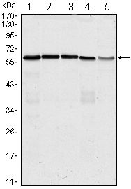 CDC25C Antibody - Cdc25C Antibody in Western Blot (WB)