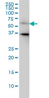 CDC25C Antibody - CDC25C monoclonal antibody (M01), clone 3B11 Western blot of CDC25C expression in HeLa.