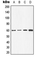 CDC25C Antibody - Western blot analysis of CDC25C expression in A431 (A); MCF7 (B); mouse kidney (C); rat heart (D) whole cell lysates.
