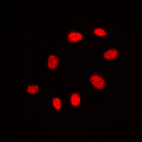 CDC25C Antibody - Immunofluorescent analysis of CDC25C staining in A431 cells. Formalin-fixed cells were permeabilized with 0.1% Triton X-100 in TBS for 5-10 minutes and blocked with 3% BSA-PBS for 30 minutes at room temperature. Cells were probed with the primary antibody in 3% BSA-PBS and incubated overnight at 4 C in a humidified chamber. Cells were washed with PBST and incubated with a DyLight 594-conjugated secondary antibody (red) in PBS at room temperature in the dark. DAPI was used to stain the cell nuclei (blue).