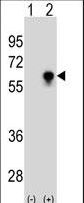 CDC25C Antibody - Western blot of CDC25C (arrow) using CDC25C Antibody. 293 cell lysates (2 ug/lane) either nontransfected (Lane 1) or transiently transfected (Lane 2) with the CDC25C gene.