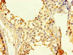 CDC25C Antibody - Immunohistochemistry of paraffin-embedded human testis tissue using CDC25C Antibody at dilution of 1:100