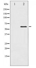 CDC25C Antibody - Western blot of CDC25C expression in HeLa whole cell lysates,The lane on the left is treated with the antigen-specific peptide.