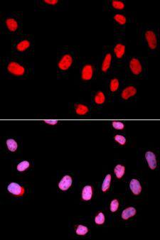 CDC25C Antibody - Immunofluorescence analysis of U2OS cells using CDC25C antibody. Blue: DAPI for nuclear staining.