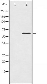 CDC25C Antibody - Western blot analysis of CDC25C expression in HeLa whole cells lysates. The lane on the left is treated with the antigen-specific peptide.