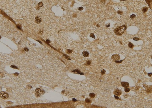 CDC25C Antibody - 1:100 staining human brain tissue by IHC-P. The sample was formaldehyde fixed and a heat mediated antigen retrieval step in citrate buffer was performed. The sample was then blocked and incubated with the antibody for 1.5 hours at 22°C. An HRP conjugated goat anti-rabbit antibody was used as the secondary.