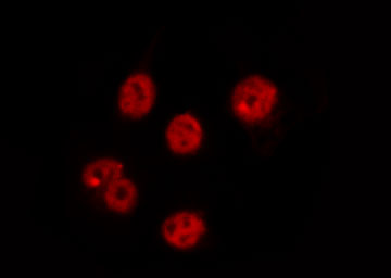 CDC25C Antibody - Staining RAW264.7 cells by IF/ICC. The samples were fixed with PFA and permeabilized in 0.1% Triton X-100, then blocked in 10% serum for 45 min at 25°C. The primary antibody was diluted at 1:200 and incubated with the sample for 1 hour at 37°C. An Alexa Fluor 594 conjugated goat anti-rabbit IgG (H+L) Ab, diluted at 1/600, was used as the secondary antibody.