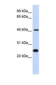 CDC25C Antibody - CDC25C antibody Western blot of Jurkat Cell lysate. Antibody concentration 1 ug/ml. This image was taken for the unconjugated form of this product. Other forms have not been tested.
