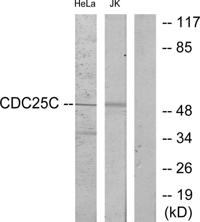 CDC25C Antibody - Western blot analysis of extracts from HeLa cells and Jurkat cells treated with UV (15mins), using CDC25C (Ab-216) antibody.