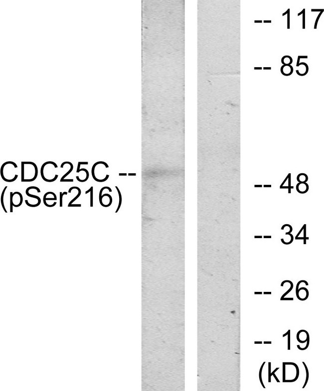 CDC25C Antibody - Western blot analysis of lysates from HUVEC cells treated with serum 20% 30', using CDC25C (Phospho-Ser216) Antibody. The lane on the right is blocked with the phospho peptide.