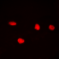 CDC25C Antibody - Immunofluorescent analysis of CDC25C (pS216) staining in HeLa cells. Formalin-fixed cells were permeabilized with 0.1% Triton X-100 in TBS for 5-10 minutes and blocked with 3% BSA-PBS for 30 minutes at room temperature. Cells were probed with the primary antibody in 3% BSA-PBS and incubated overnight at 4 deg C in a humidified chamber. Cells were washed with PBST and incubated with a DyLight 594-conjugated secondary antibody (red) in PBS at room temperature in the dark. DAPI was used to stain the cell nuclei (blue).