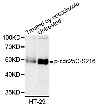 CDC25C Antibody - Western blot analysis of extracts of HT-29 cells.