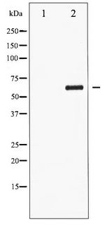CDC25C Antibody - Western blot of CDC25C phosphorylation expression in serum treated HUVEC whole cell lysates,The lane on the left is treated with the antigen-specific peptide.