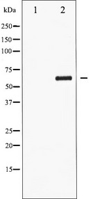 CDC25C Antibody - Western blot analysis of CDC25C phosphorylation expression in serum treated HuvEc whole cells lysates. The lane on the left is treated with the antigen-specific peptide.
