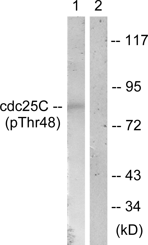 CDC25C Antibody - Western blot analysis of lysates from RAW264.7 cells, using CDC25C (Phospho-Thr48) Antibody. The lane on the right is blocked with the phospho peptide.