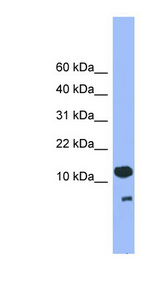CDC26 Antibody - CDC26 antibody Western blot of Placenta lysate. This image was taken for the unconjugated form of this product. Other forms have not been tested.