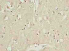 CDC26 Antibody - Immunohistochemistry of paraffin-embedded human brain tissue using antibody at dilution of 1:100.