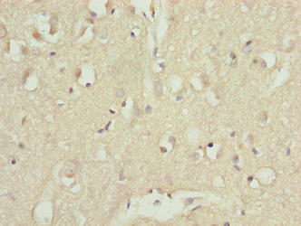 CDC26 Antibody - Immunohistochemistry of paraffin-embedded human brain tissue using CDC26 Antibody at dilution of 1:100