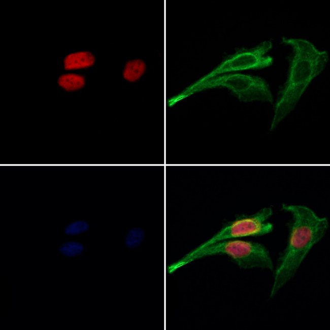 CDC26 Antibody - Staining HeLa cells by IF/ICC. The samples were fixed with PFA and permeabilized in 0.1% Triton X-100, then blocked in 10% serum for 45 min at 25°C. Samples were then incubated with primary Ab(1:200) and mouse anti-beta tubulin Ab(1:200) for 1 hour at 37°C. An AlexaFluor594 conjugated goat anti-rabbit IgG(H+L) Ab(1:200 Red) and an AlexaFluor488 conjugated goat anti-mouse IgG(H+L) Ab(1:600 Green) were used as the secondary antibod