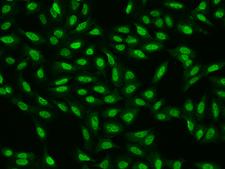 CDC26 Antibody - Immunofluorescence staining of CDC26 in U2OS cells. Cells were fixed with 4% PFA, permeabilzed with 0.1% Triton X-100 in PBS, blocked with 10% serum, and incubated with rabbit anti-Human CDC26 polyclonal antibody (dilution ratio 1:200) at 4°C overnight. Then cells were stained with the Alexa Fluor 488-conjugated Goat Anti-rabbit IgG secondary antibody (green). Positive staining was localized to Nucleus.