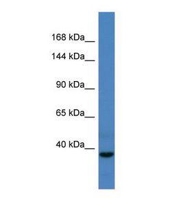 CDC27 Antibody - Western blot of Human Fetal Liver. CDC27 antibody dilution 1.0 ug/ml.  This image was taken for the unconjugated form of this product. Other forms have not been tested.