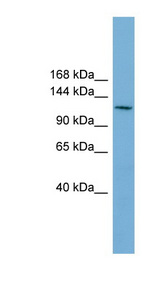 CDC27 Antibody - CDC27 antibody Western blot of NCI-H226 cell lysate. This image was taken for the unconjugated form of this product. Other forms have not been tested.