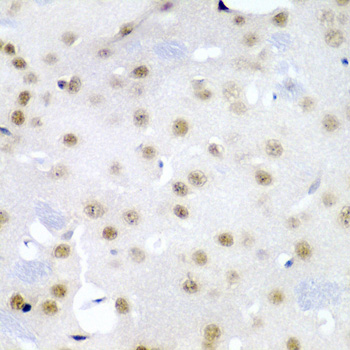 CDC27 Antibody - Immunohistochemistry of paraffin-embedded mouse brain using CDC27 antibody at dilution of 1:200 (40x lens).